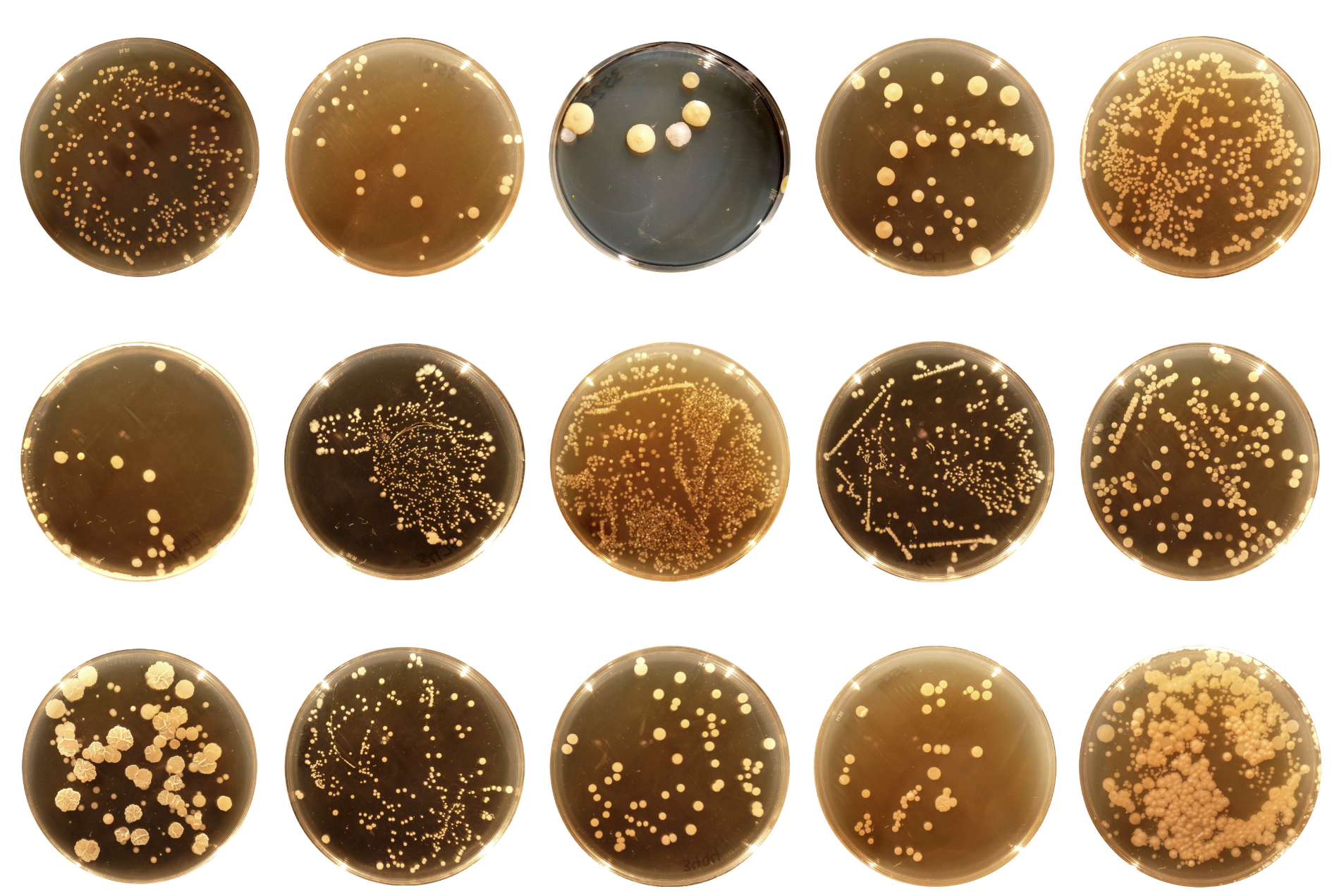 Bacterial Analysis